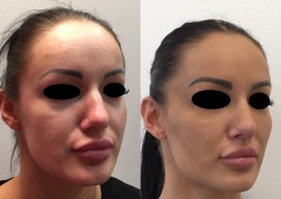 Modelovanie tváre